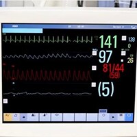 EKG-overvågningsalarmer