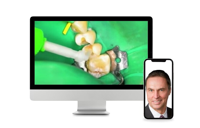 Webinar omkring cementering og limning af dentale materialer
