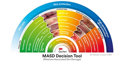 Billede der illustrerer hvordan MASD produktværktøjet virker
