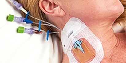 Nationale evidensbaserede retningslinjer til forebyggelse af infektioner i sundhedssektoren
