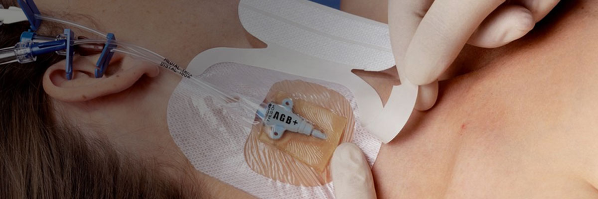 3M™ Tegaderm™ CHG IV-forbindinger
