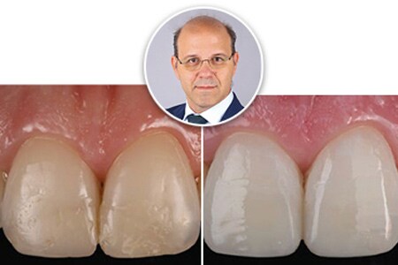 klinisk case thumbnail
