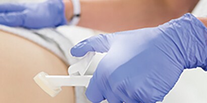 Cavilon™ Advanced Hudbeskyttelse anvendt på en patient 
