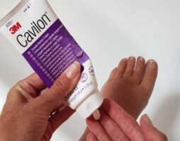 cavilon hudpleje ødem
