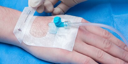 IV-forbindinger til indstikssteder
